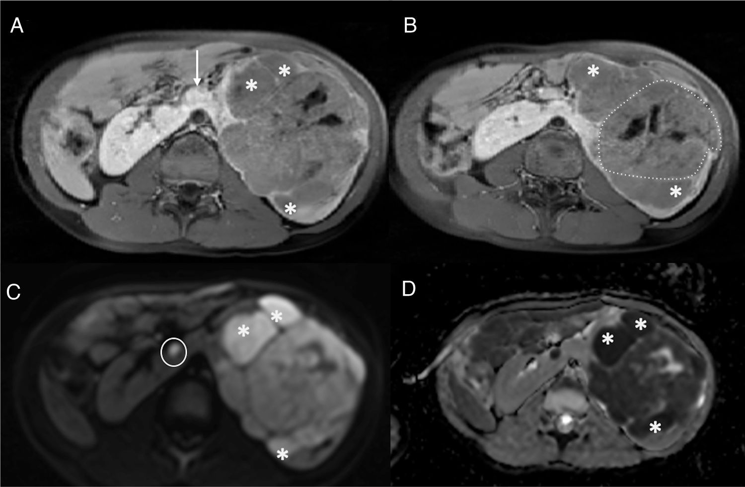 TC y RMN de Abdomen y Pelvis